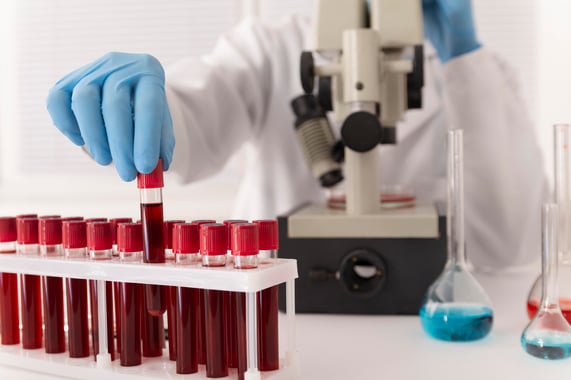 Hematología
