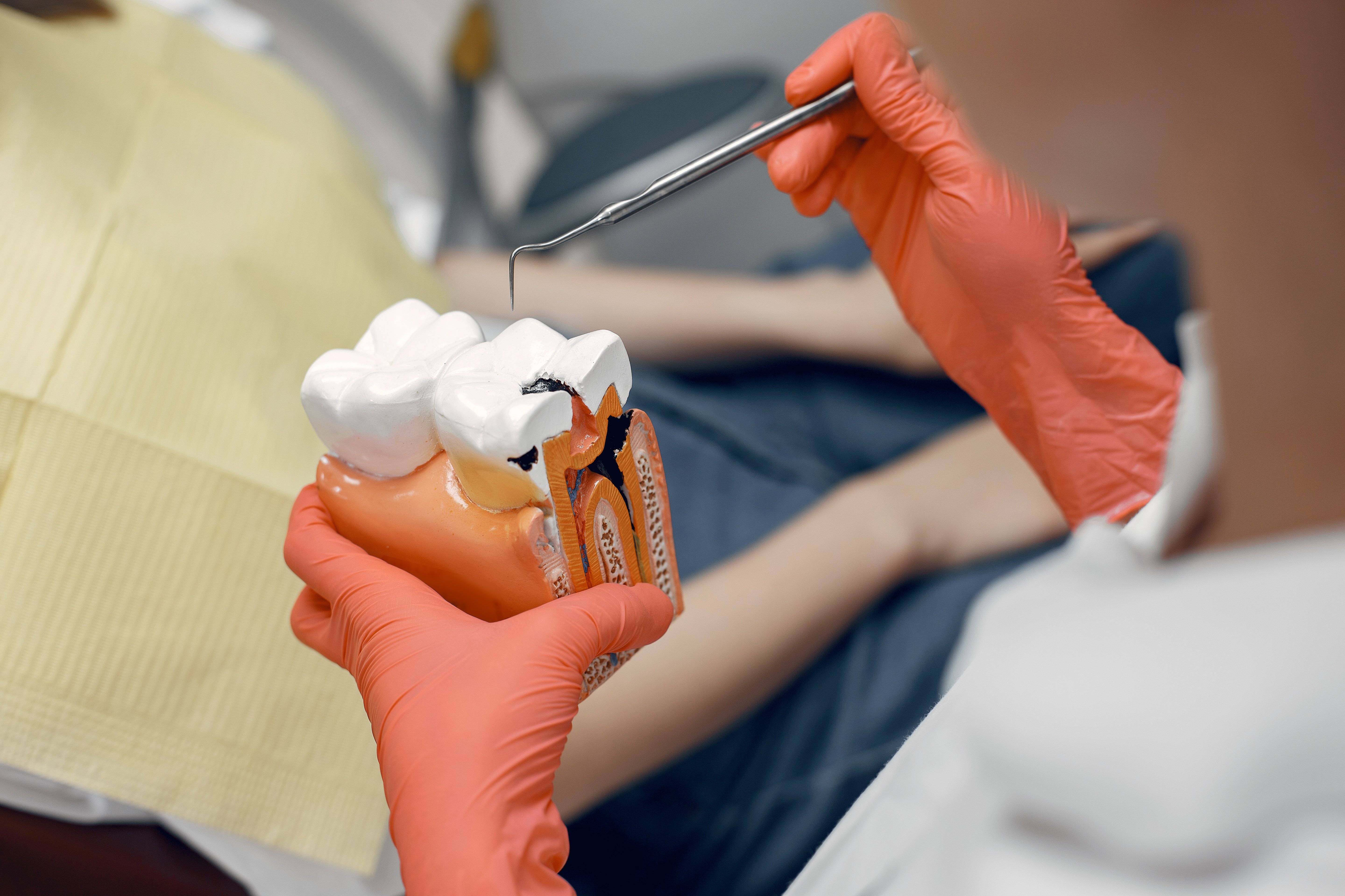 modelo-de-un-diente-en-el-dentista-el-doctor-muestra-al-paciente-un-diente-recepcion-en-el-consultorio-del-dentista