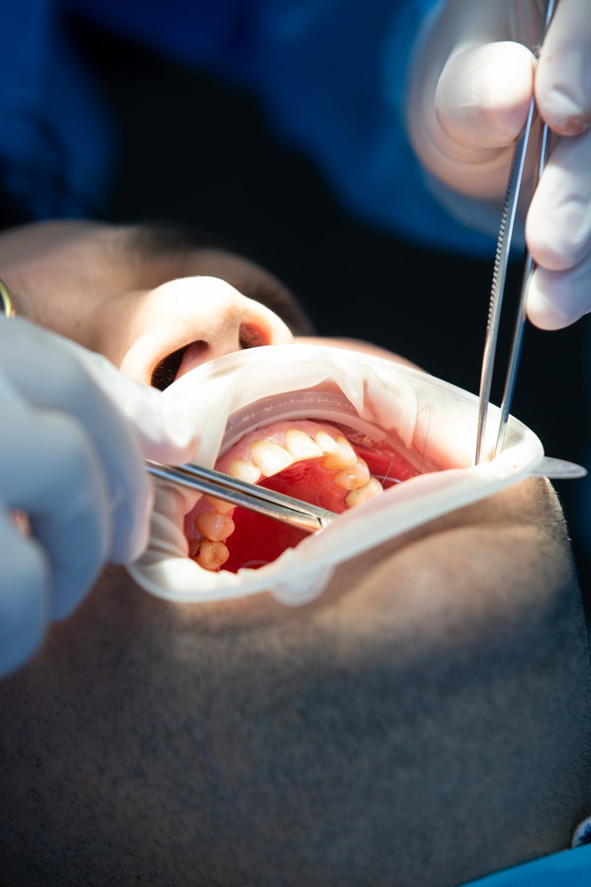 paciente-en-clinica-dental-mientras-opera