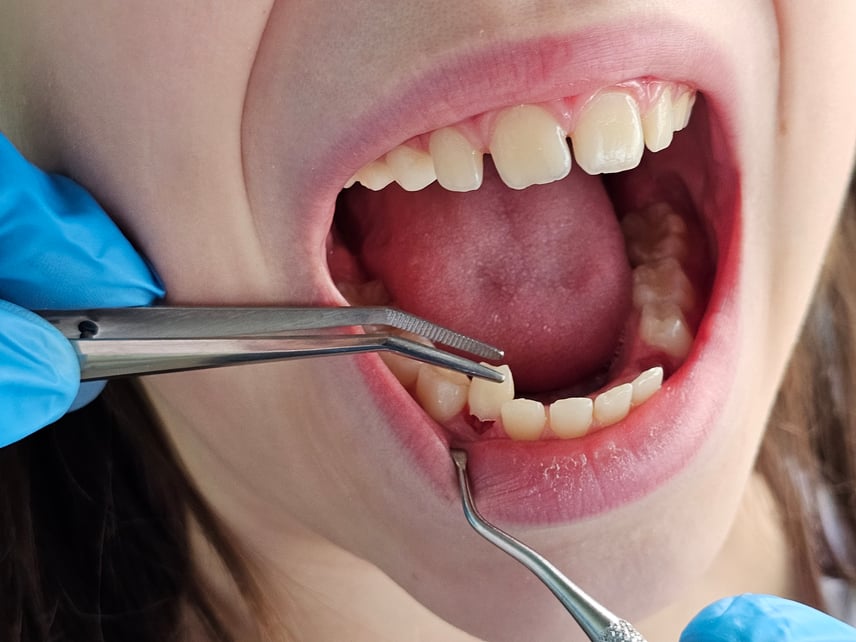 que-es-periodoncia